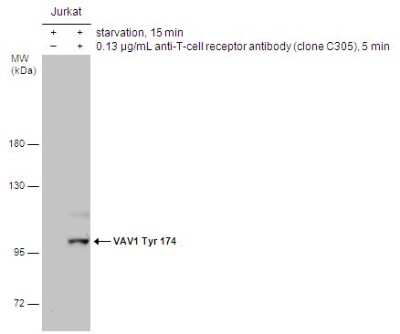 Western Blot: Vav-1 [p Tyr174] Antibody [NBP3-13139]